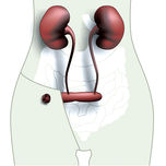 Urostomie:  Harnausgang 